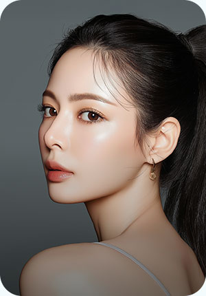 id 윤곽 재수술